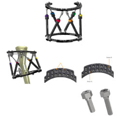 External Fixator